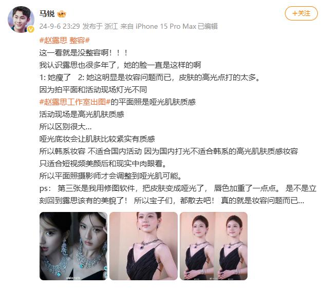 趙露思否認整容并反問:整容犯法嗎